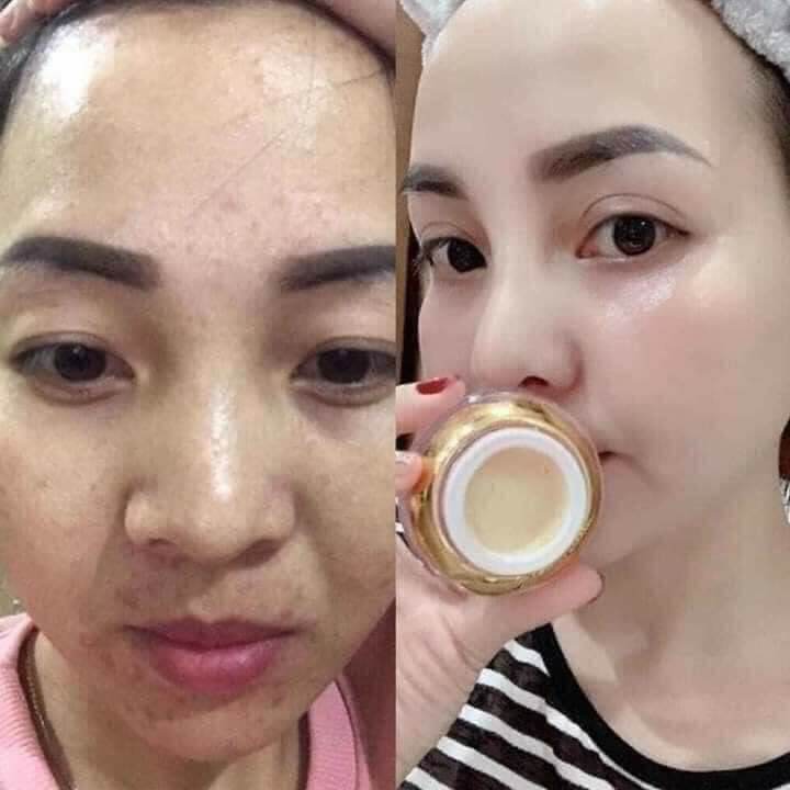 kem hoàng cung hồng sét 5 món