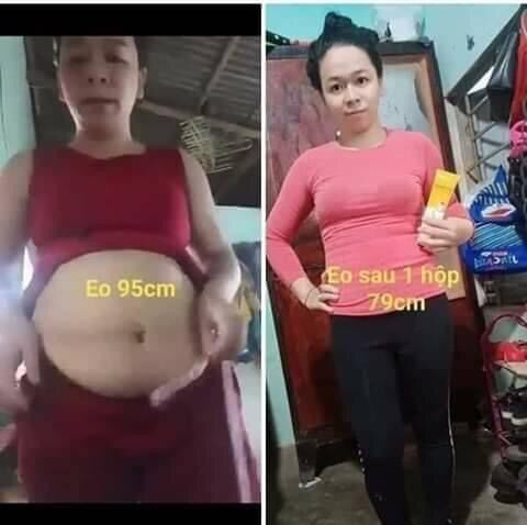 Kem tan mỡ , đánh tan mỡ bụng, bắp chân , bắp tay, mông , đùi...