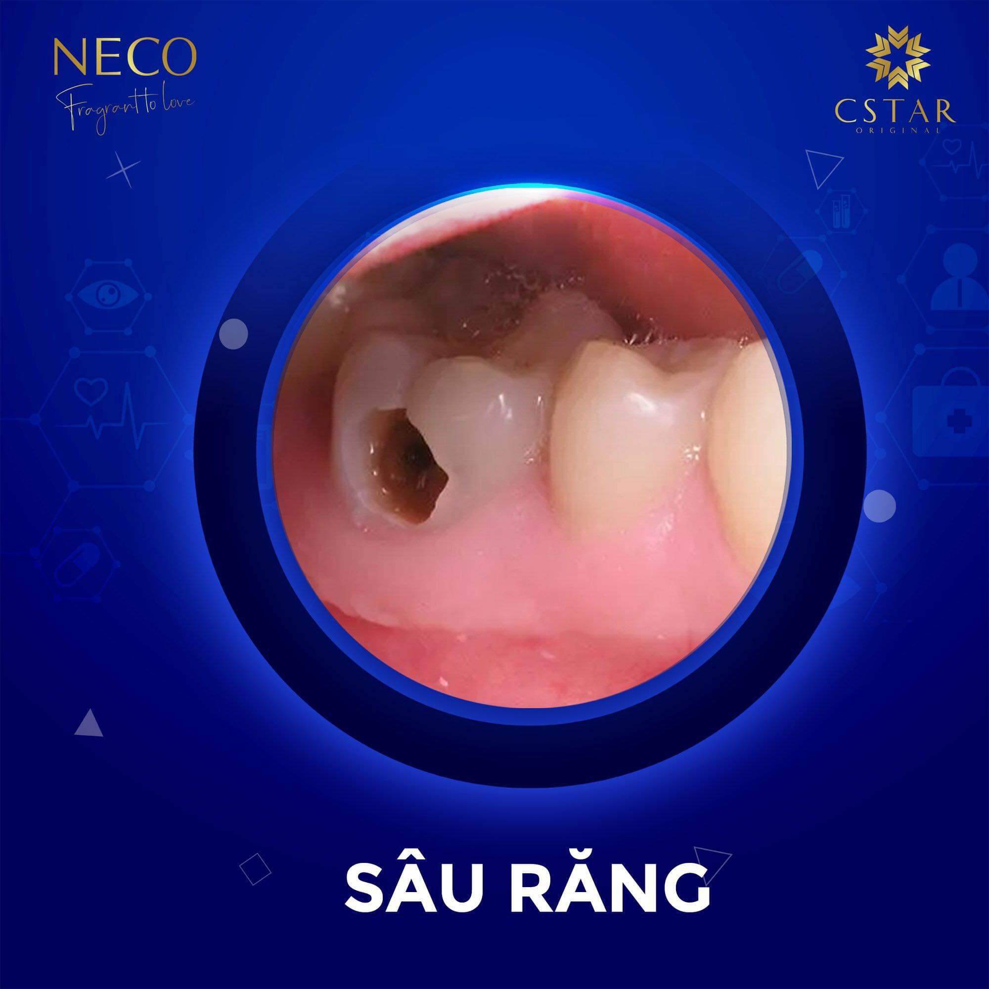CỐT THIÊN NGỌC NECO