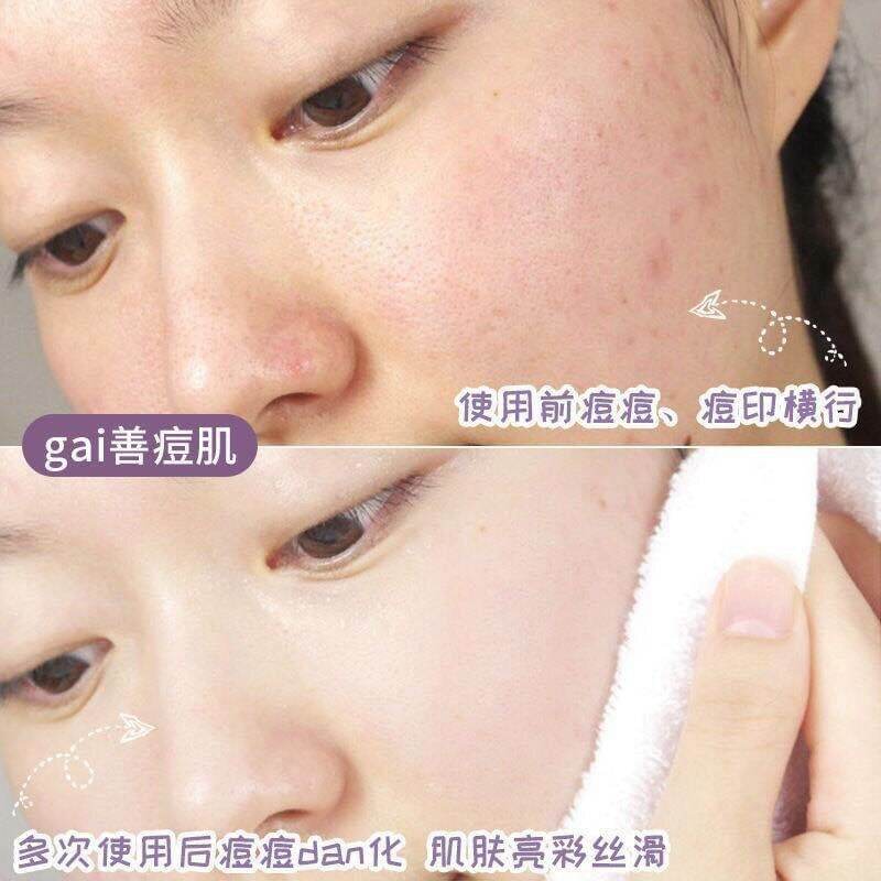 Nạ Đất Sét Trà Xanh Dạng Lăn