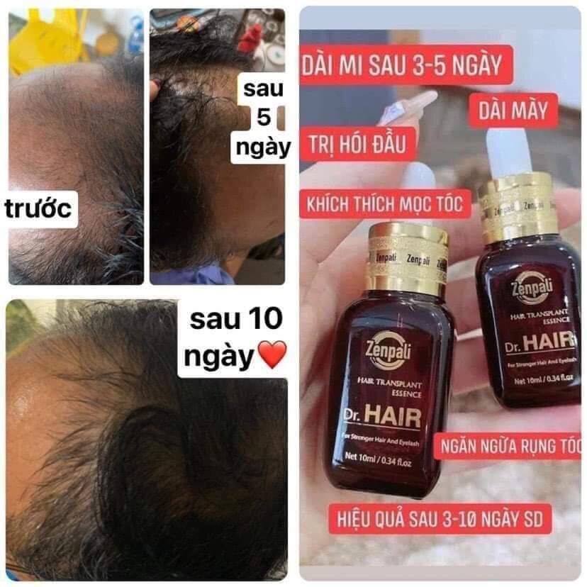 DR.HAIR (kích mọc mi tóc cực nhanh)