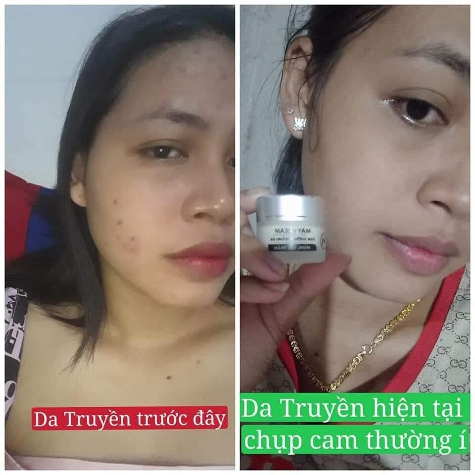 [HCM]KEM FACE THANH MÂY - MÂY CREAM - LOẠI MỤN MỜ THÂM
