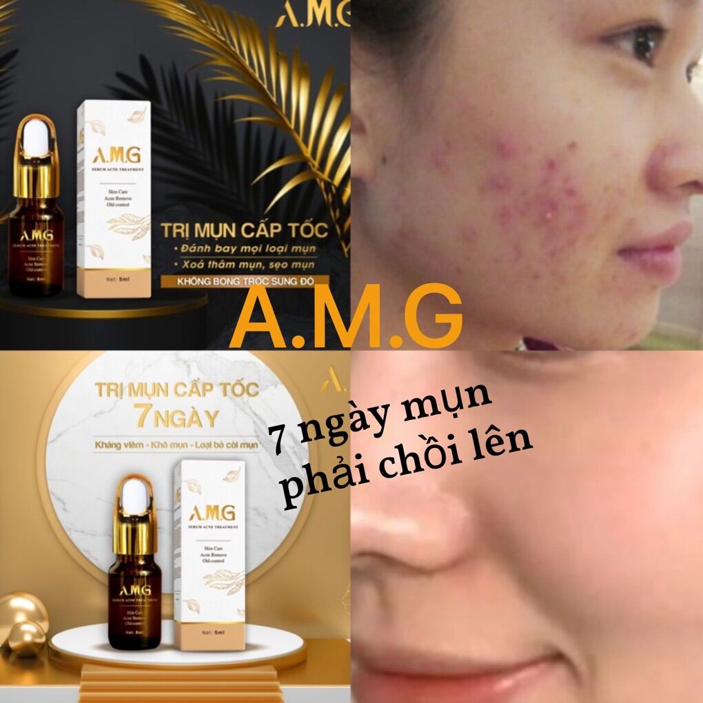 [Hcm]Thảo Mộc Amg Skin Care ( Tặng Son Kem Laneige )