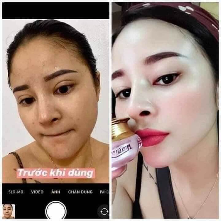 kem hoàng cung hồng sét 5 món