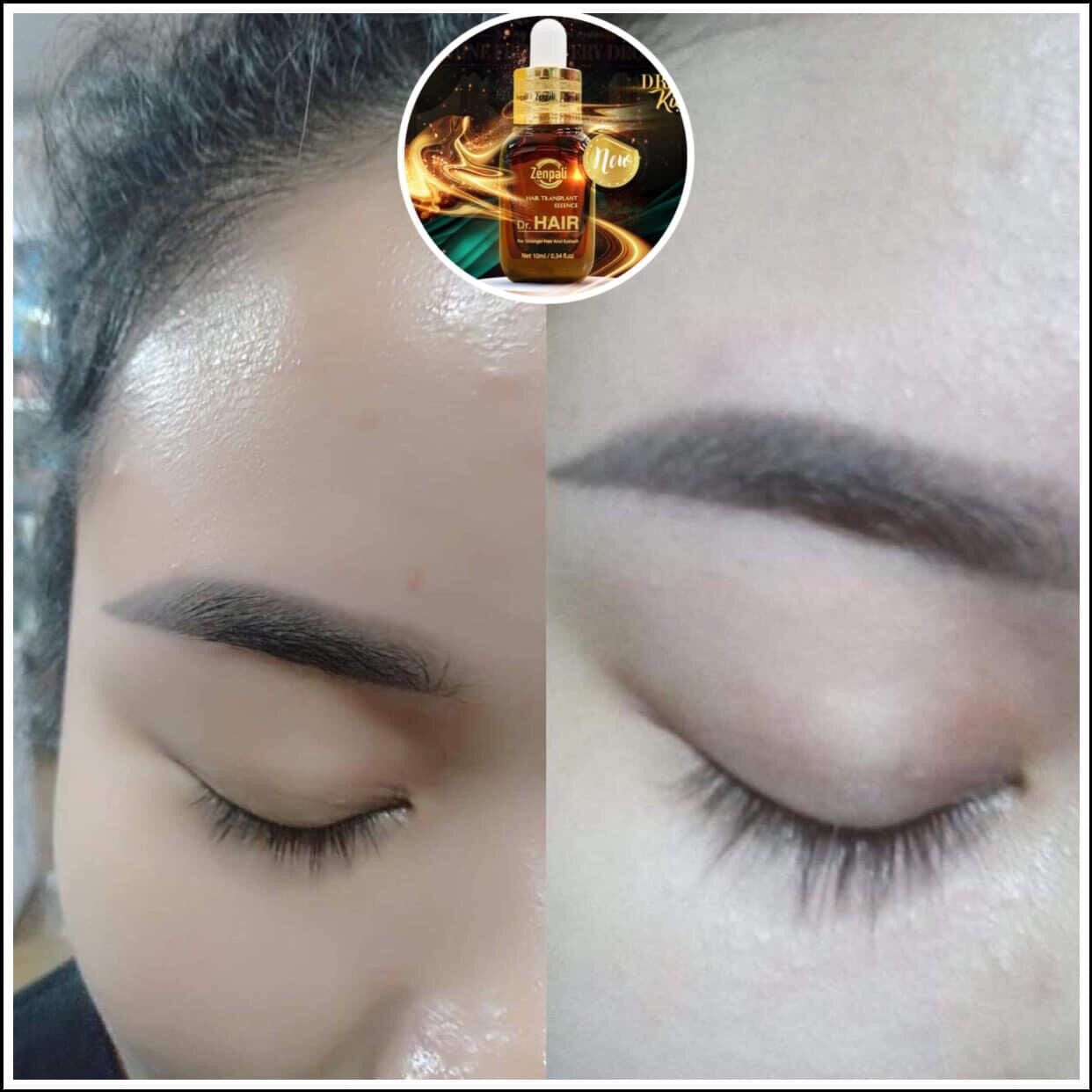 DR.HAIR (kích mọc mi tóc cực nhanh)