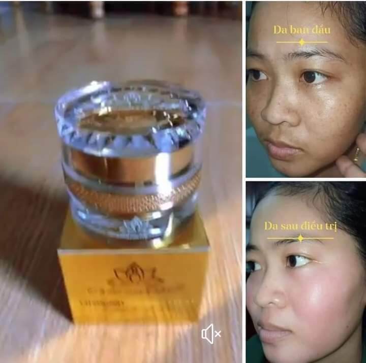 KEM TÁI TẠO CHAMOMILESKILL HÀNG CHÍNH HÃNG