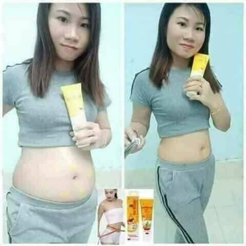 Kem tan mỡ , đánh tan mỡ bụng, bắp chân , bắp tay, mông , đùi...