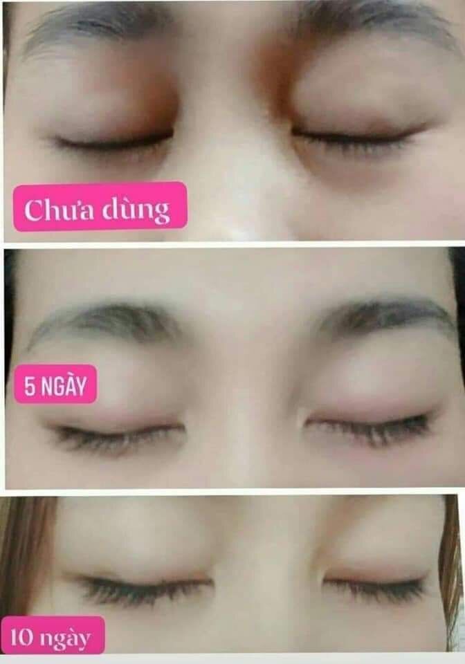 DR.HAIR (kích mọc mi tóc cực nhanh)