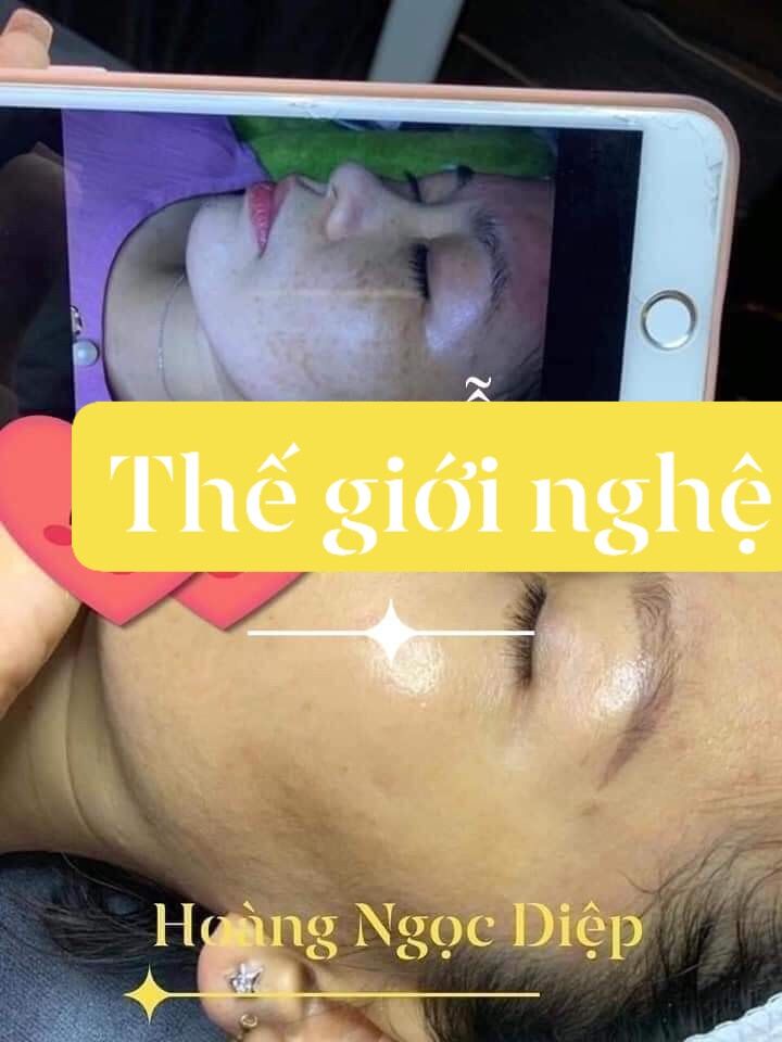 [HCM]vua nám nghệ collagen ngày