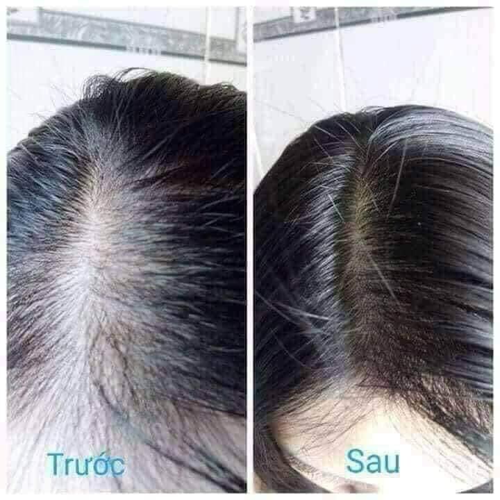 TINH DẦU BƯỞI NGUYÊN CHẤT KÍCH THÍCH MỌC TÓC ,lọ 60ml [NOON FASHION]