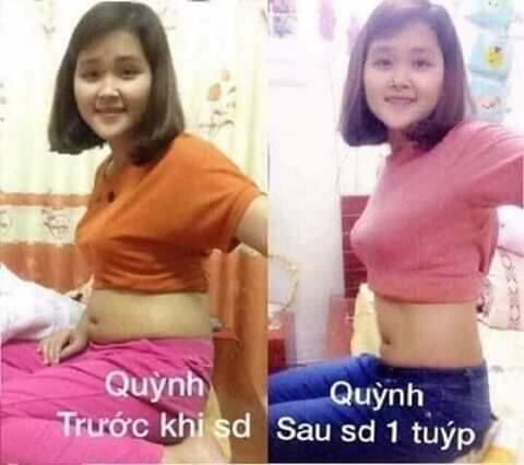 Kem tan mỡ , đánh tan mỡ bụng, bắp chân , bắp tay, mông , đùi...