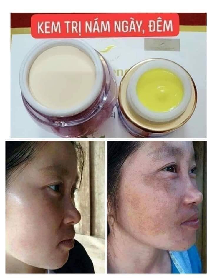 [HCM]vua nám nghệ collagen ngày