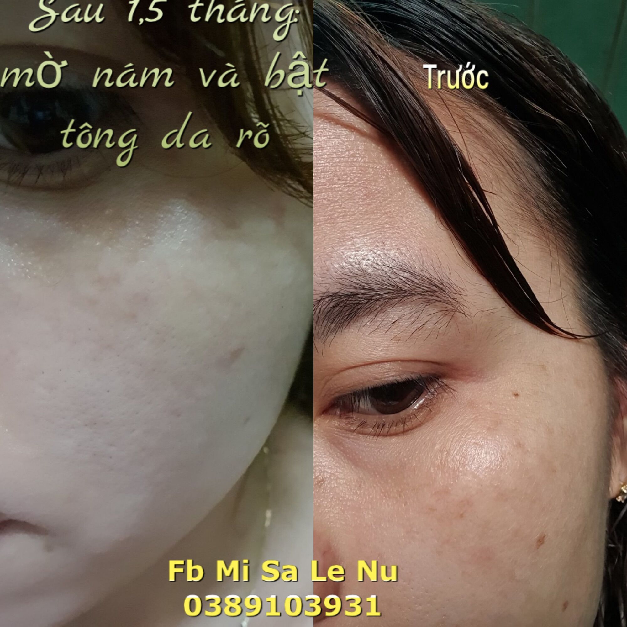 [HCM]vua nám nghệ collagen ngày