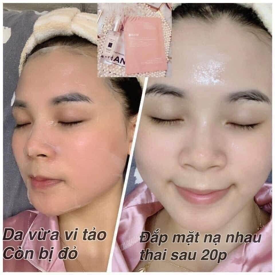 [HCM]nạ nhau thai cừu nhật bản  (1 hộp 50 cái)