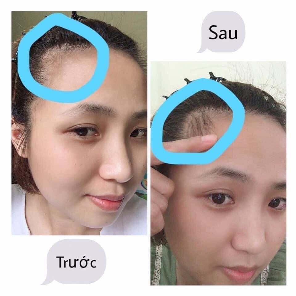 DR.HAIR (kích mọc mi tóc cực nhanh)