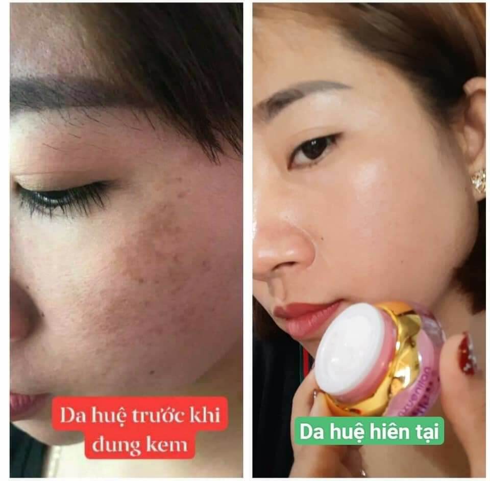 kem hoàng cung hồng sét 5 món