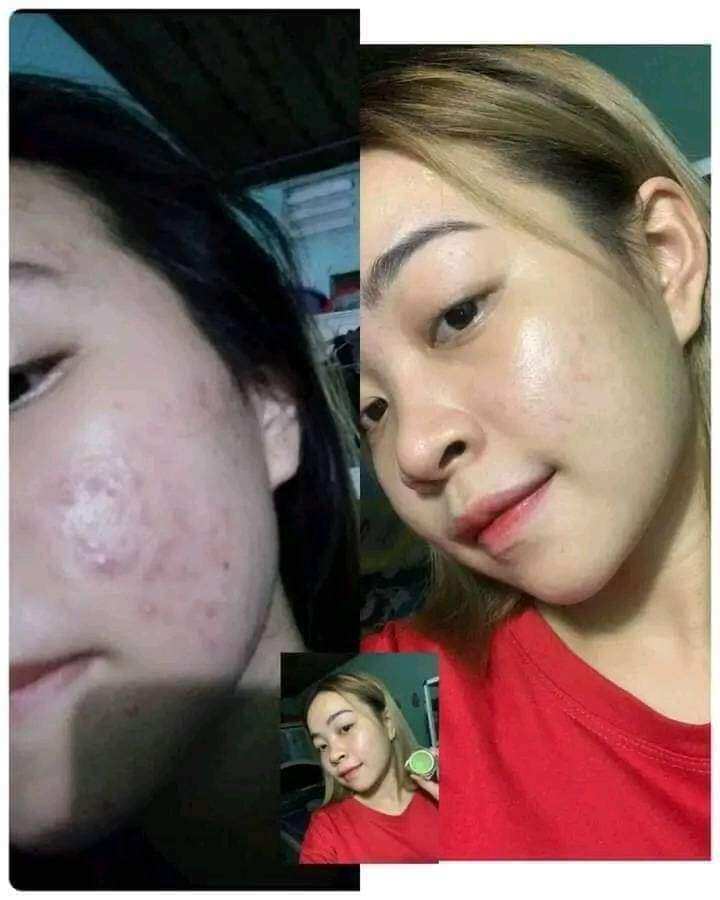kem face trà xanh bích cao white