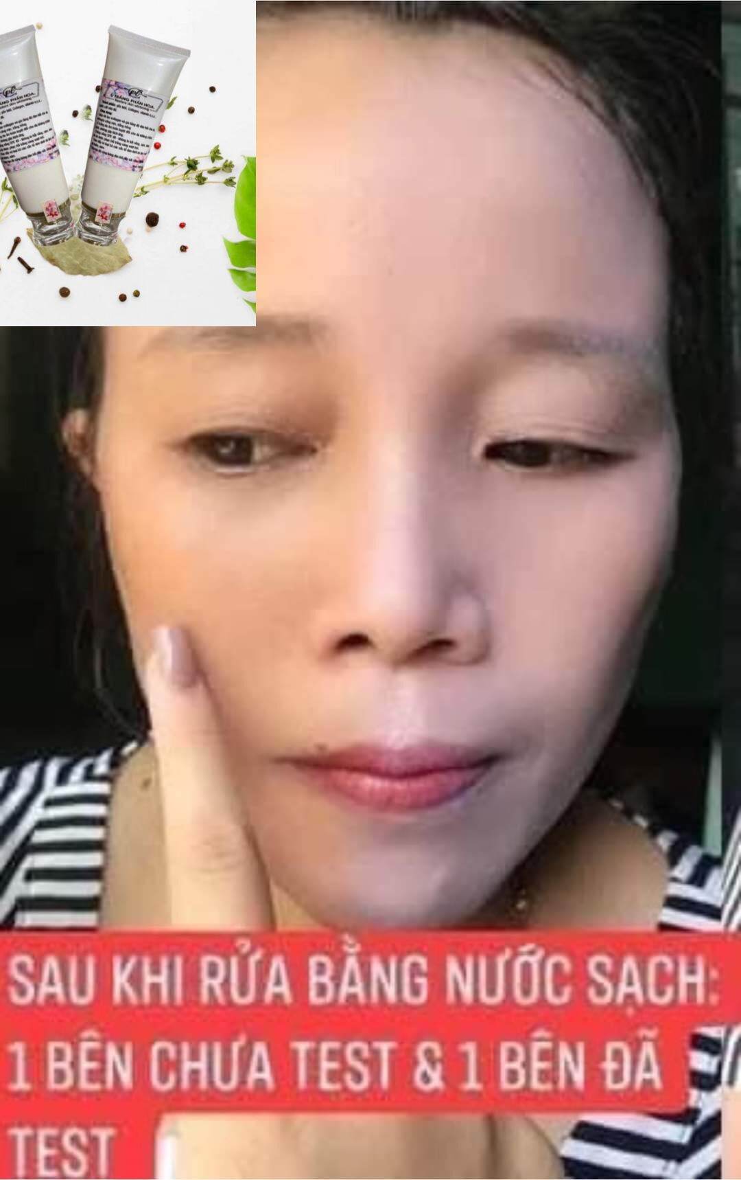 ủ trắng  da mặt phấn hoa.