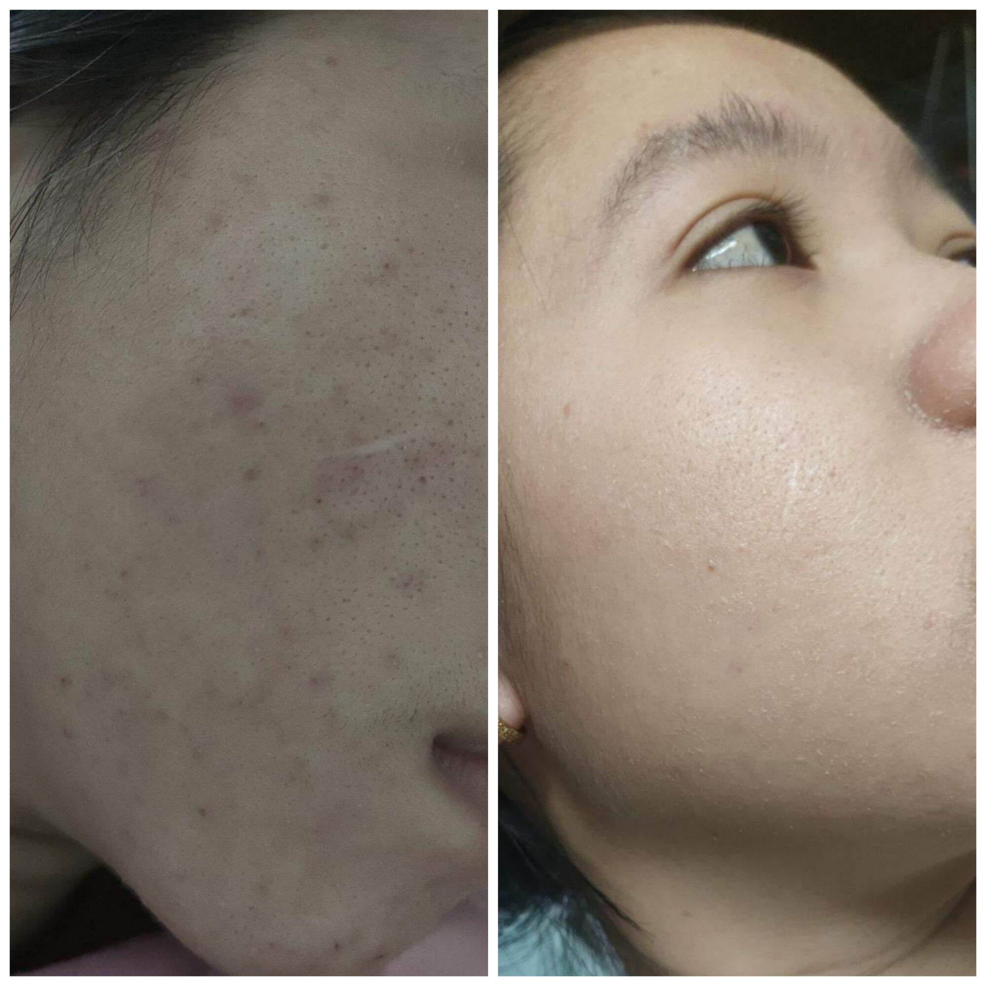 Đông y Sắc Ngọc Nữ tái tạo da