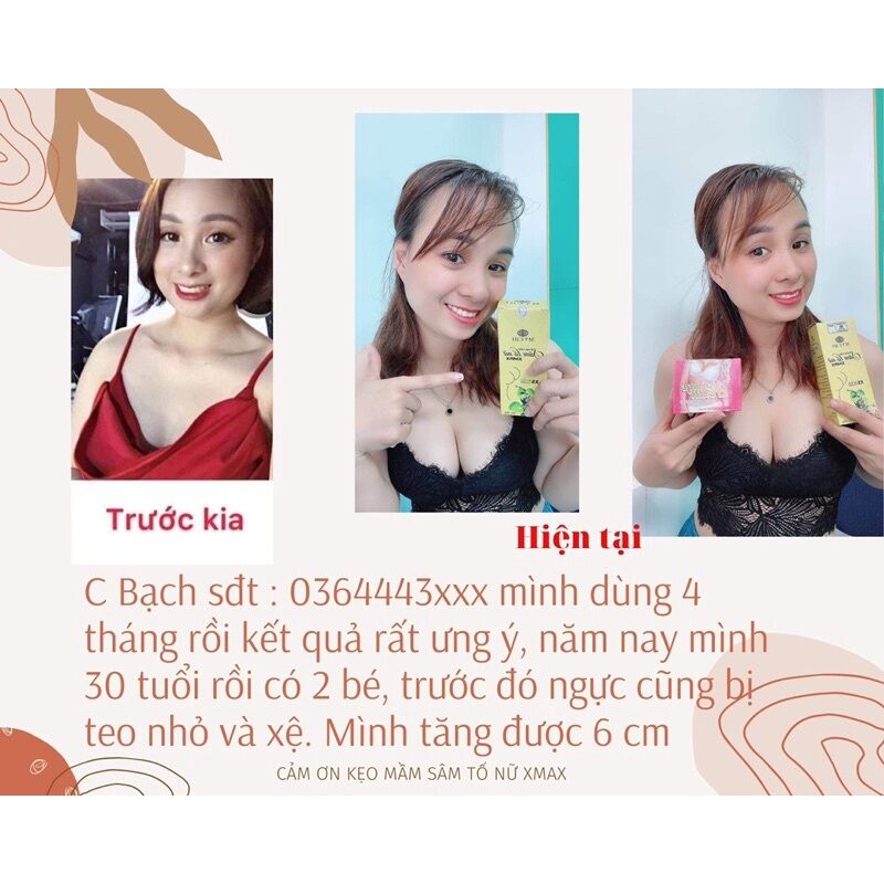 Kẹo mầm sâm tố nữ Xmax (mua 4 tặng 1= 5 hộp)