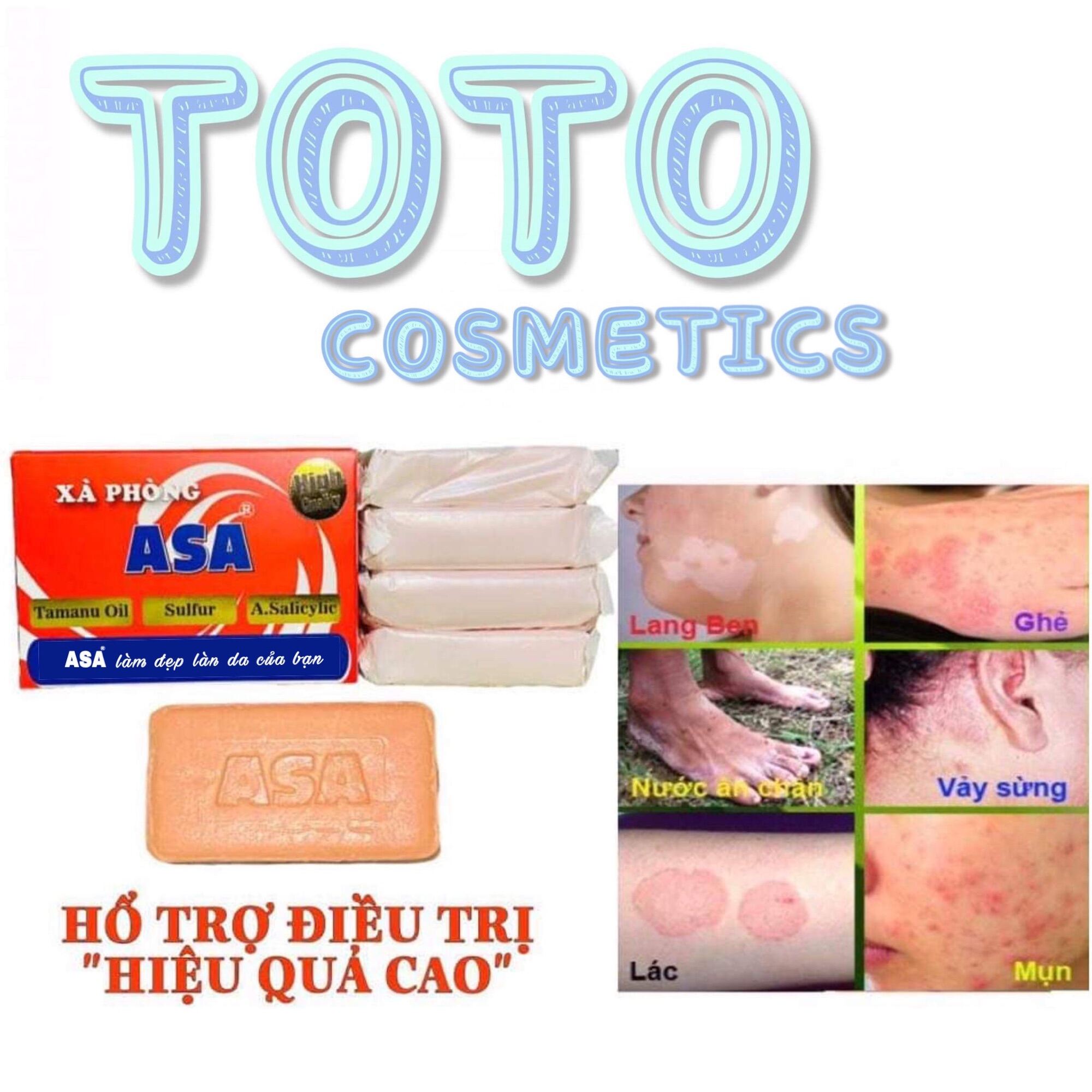 [HCM][MUA 1 TẶNG 1] Xà Bông ASA 120g Hỗ Trợ Điều Trị Viêm Da - Ghẻ  Nấm Da  Lác  Vảy Sừng “Cực Hiệu Quả”