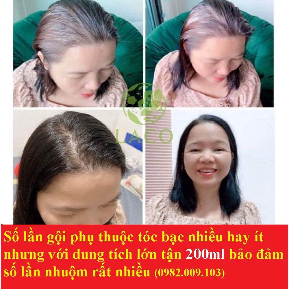 Dầu Gội Phủ Bạc LACO Chính Hãng