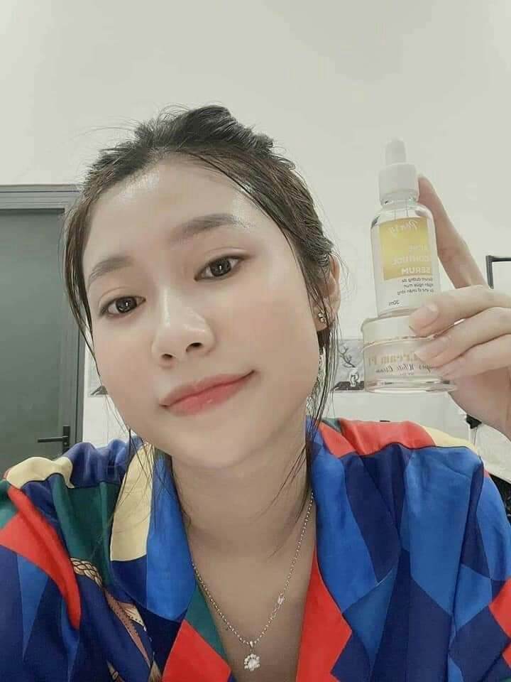 _ Combo kem face P1 + serum Acne