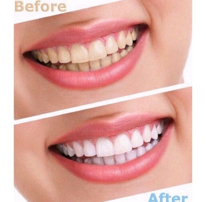 SET 5 HỘP KEM ĐÁNH RĂNG COLGATE HÀNG NHẬP CHUẨN MỸ