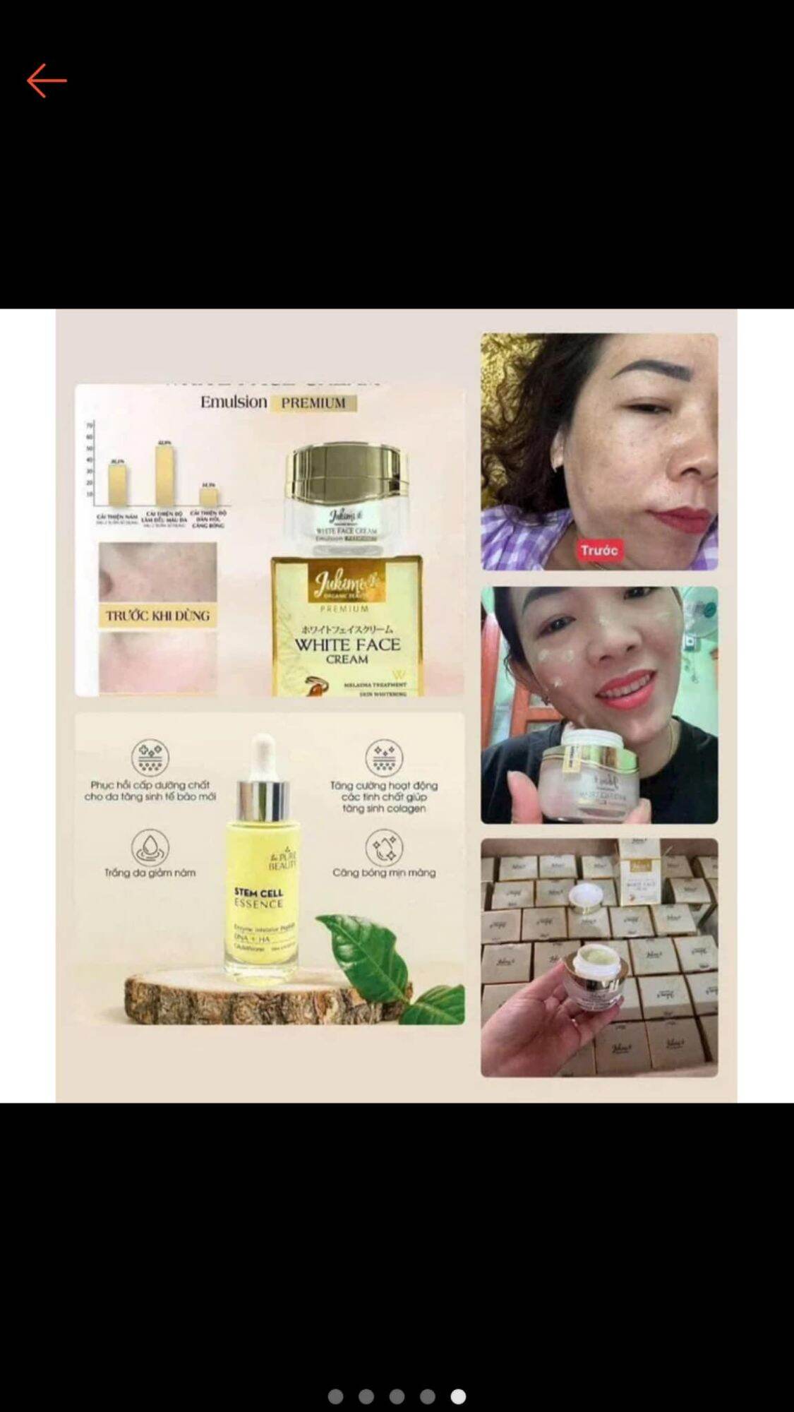 kem Jukimi kem trị nám tàn nhang  . nhật bản 30ml