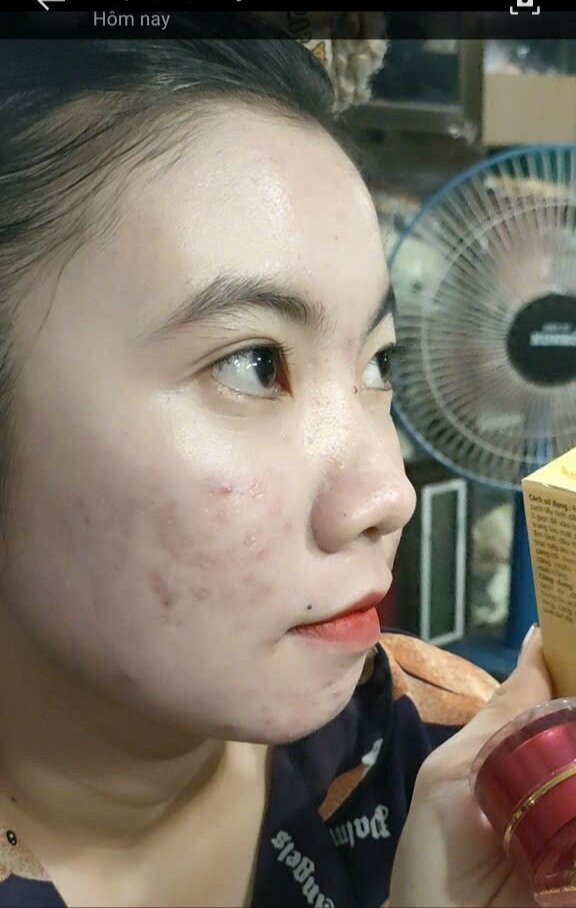 kem mặt ngọc Oanh
