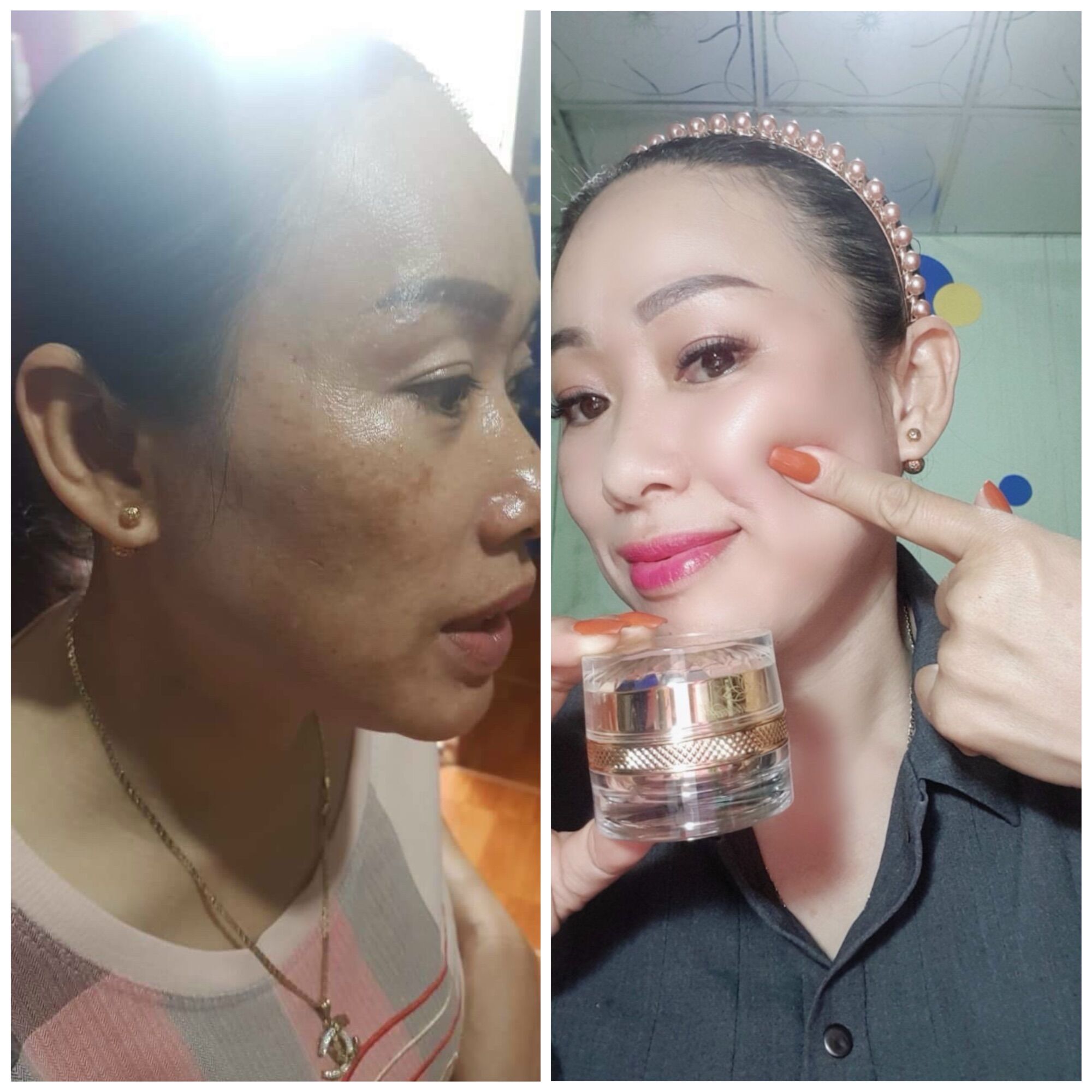 [HCM]KEM TÁI TẠO CHAMOMILESKILL