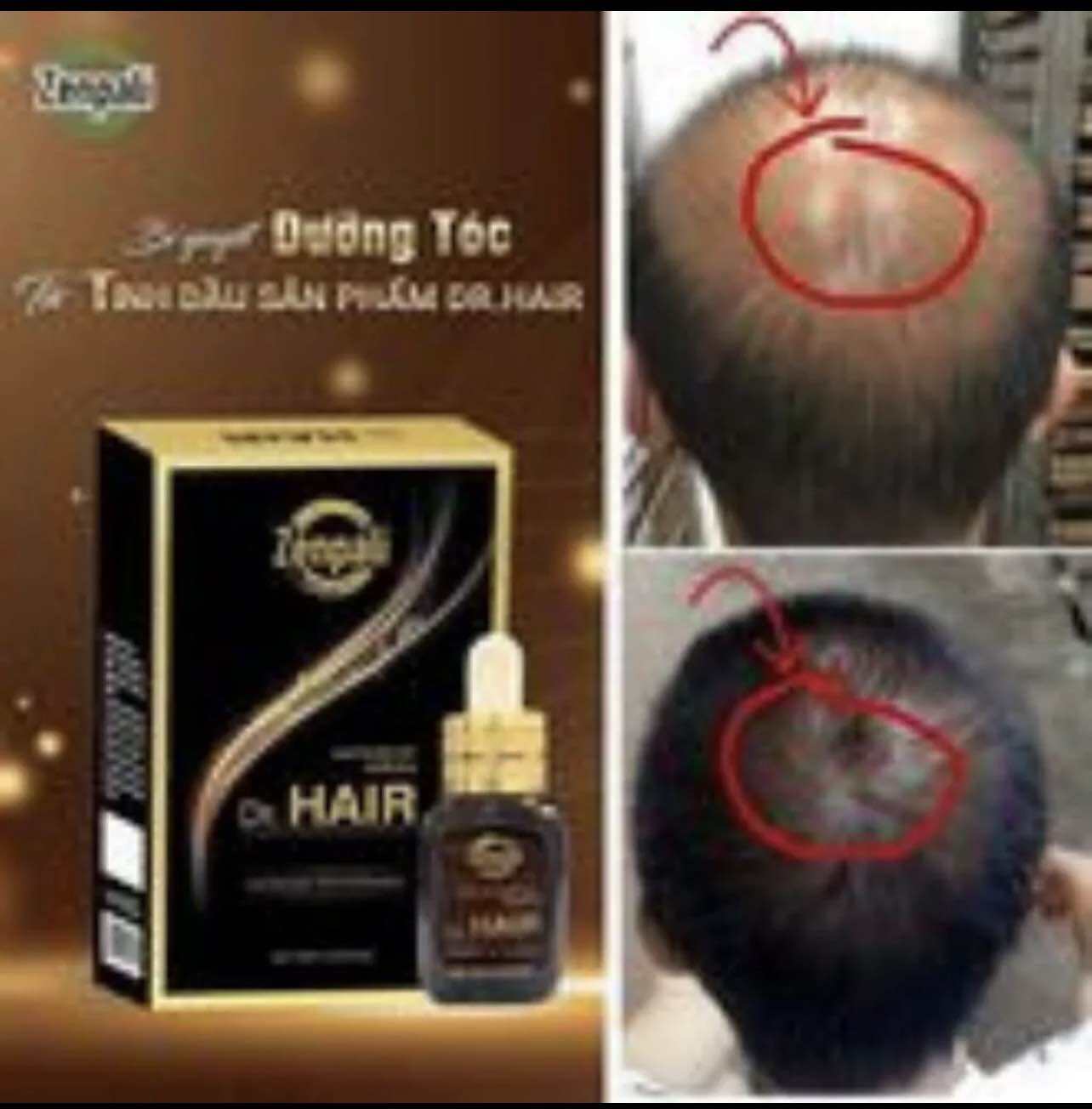 Tinh Chất Serum Kích Mọc Tóc Dài Mi Dr Hair - Mọc Tóc Dr Hair