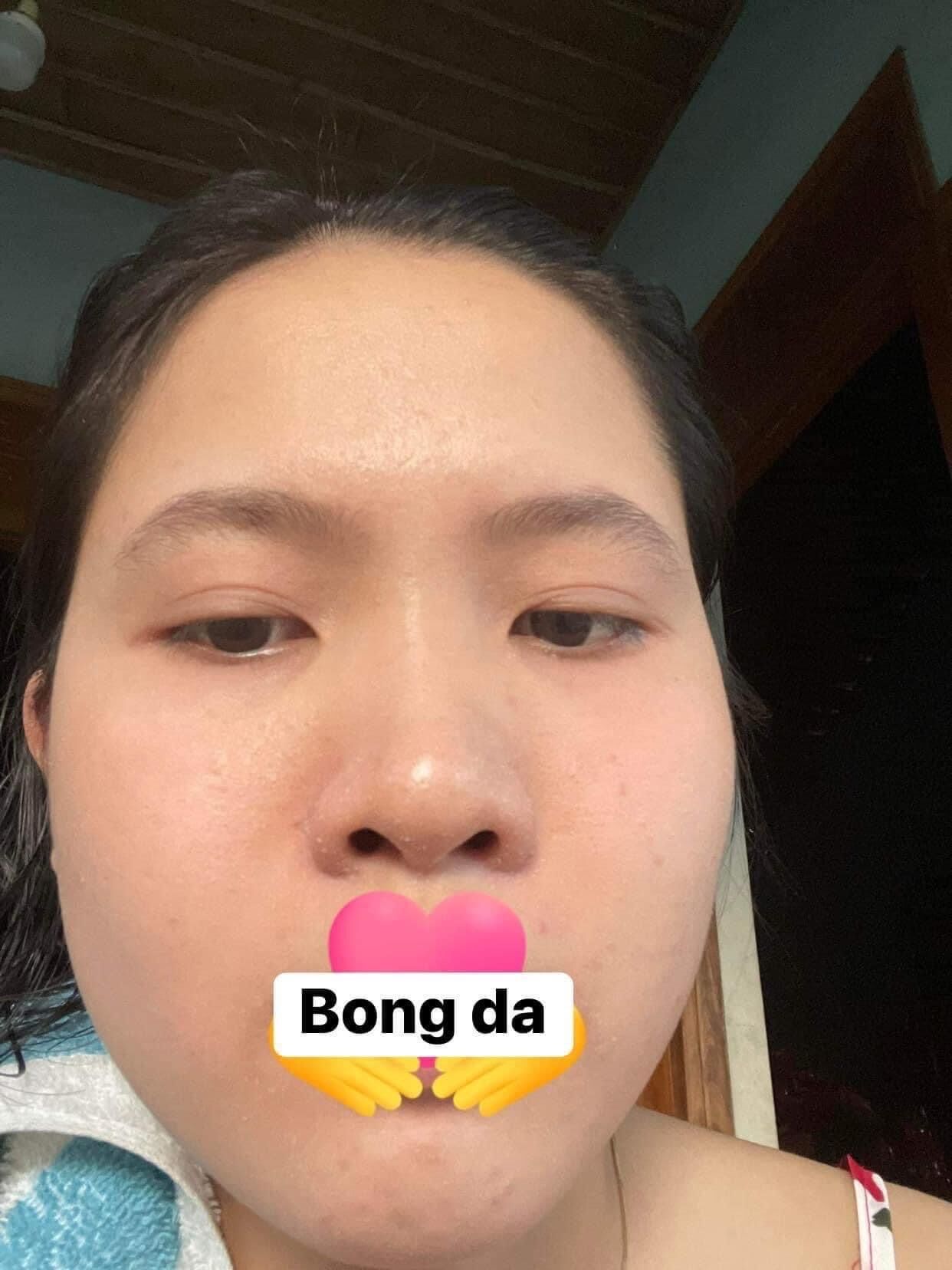 KEM FACE YẾN MẠCH TR.Ị THÂ.M, MỤ.N