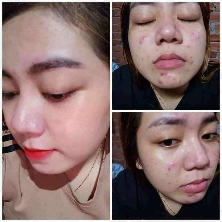 kem Face Ngọc Oanh