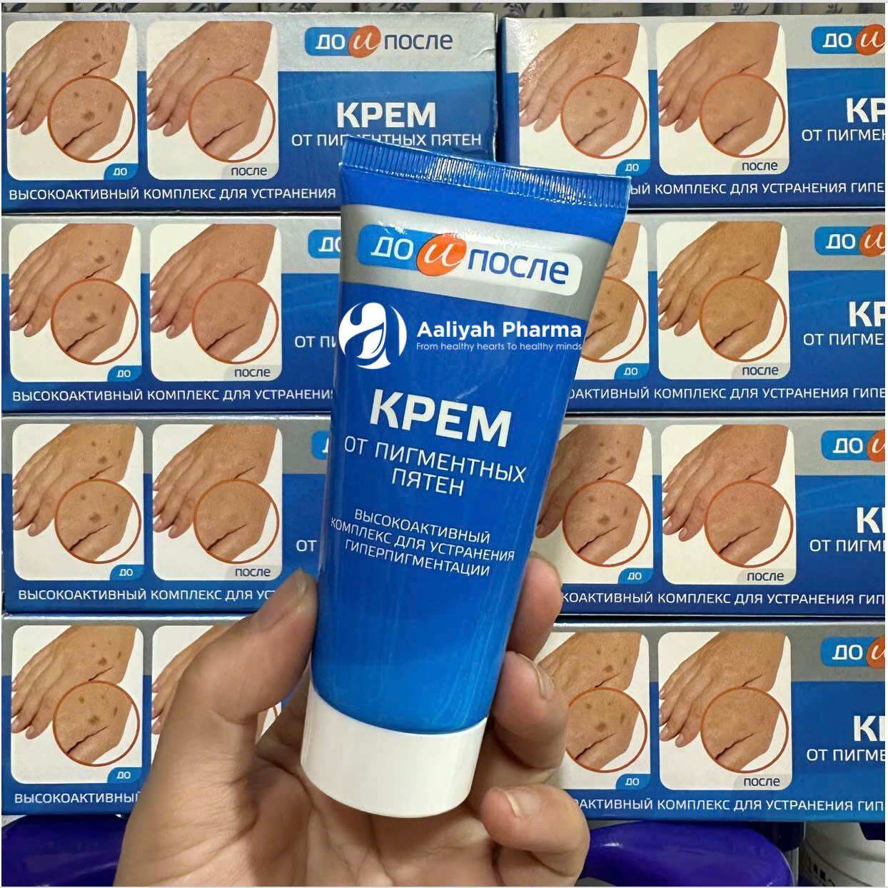 Da tay đồi mồi, đốm nâu Kem trị Kpem 50g của Nga