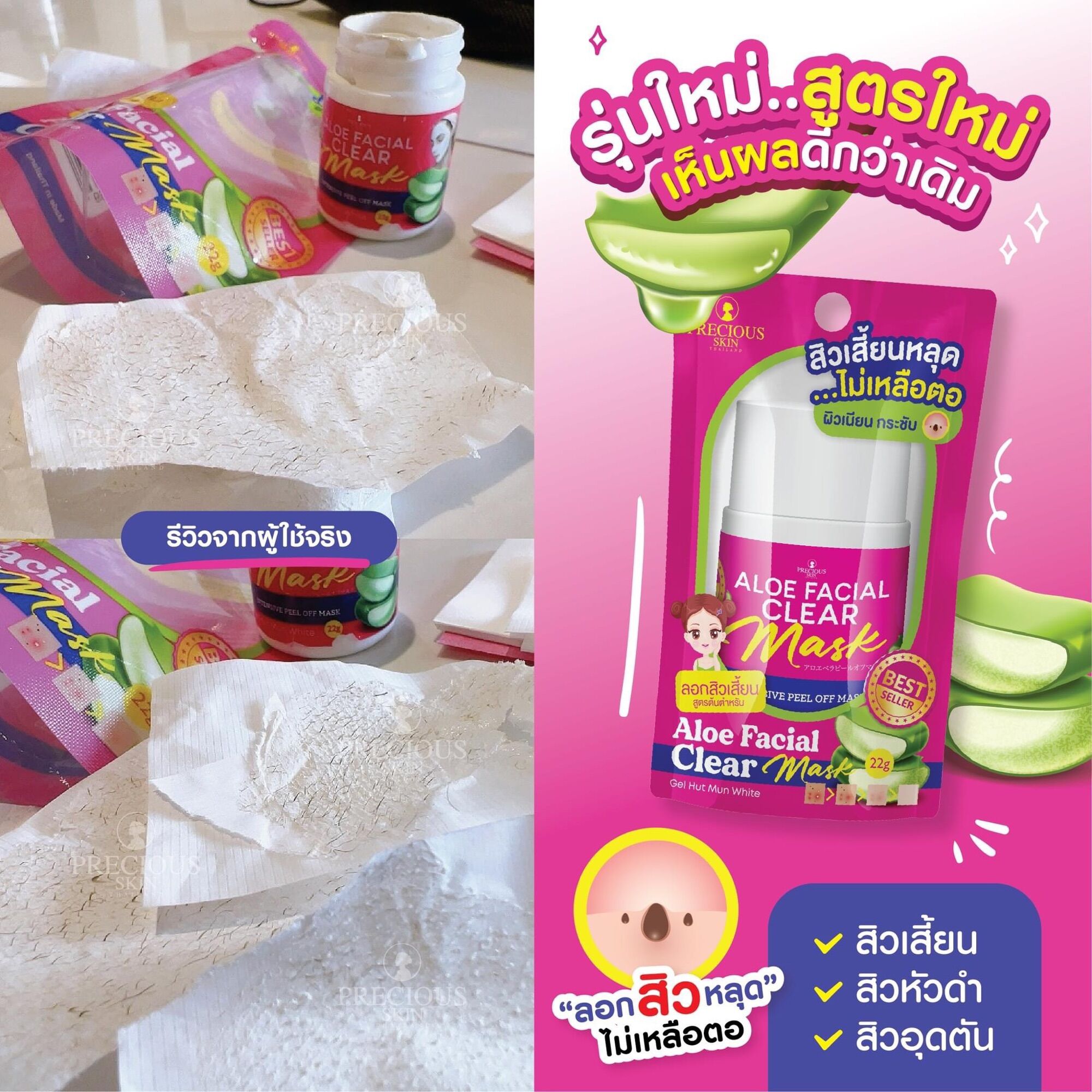 Gel lột mụn nha đam thái lan