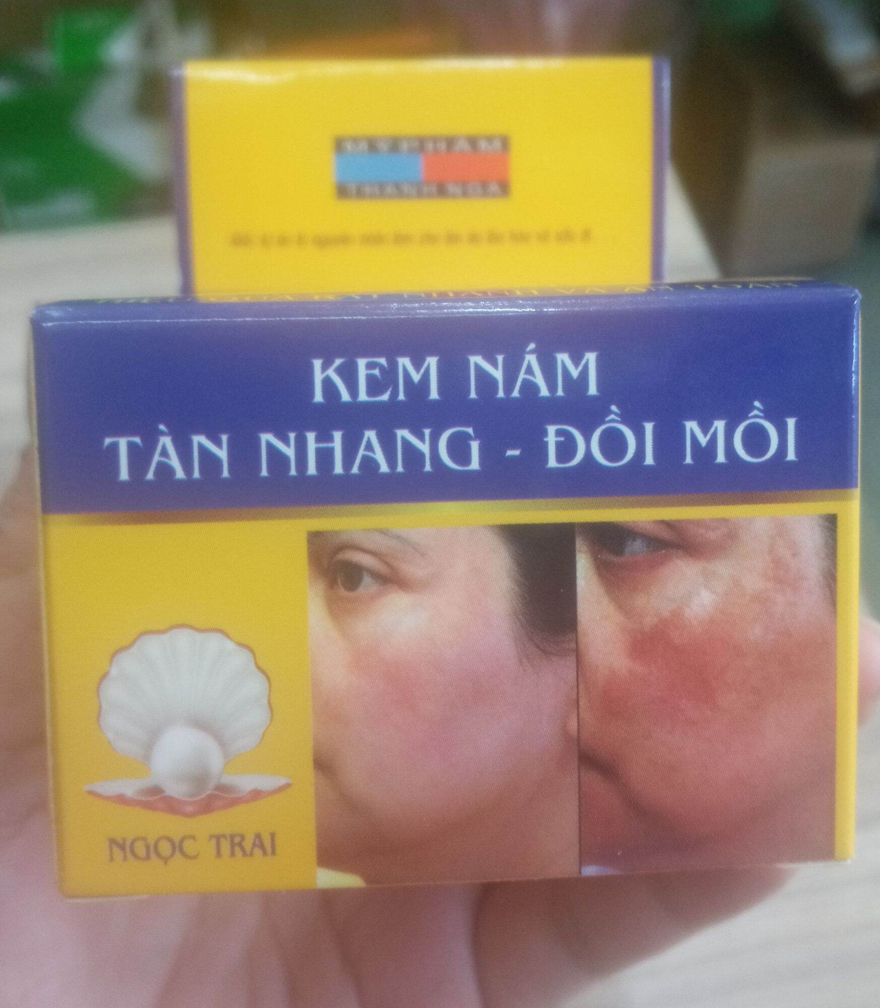 kem Aihao nám tàn nhang đồi mồi 10g