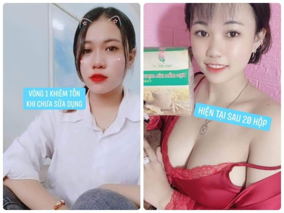 (3 Hộp Mầm) Kẹo Mầm Lúa Mạch Gold Tăng Size Vòng 1 Gấp 20 Lần So Với Mầm Đậu Nành Thông Thường.lựa Chọn Hàng Đầu Của Phái Đẹp