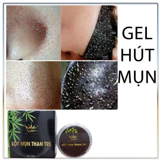 Gel hút mụn than tre 30g