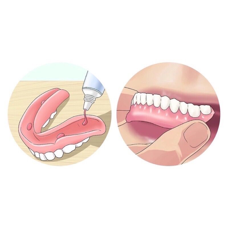 Keo dán hàm răng giả Fixodent Plus/Ultra Scope 57g Mỹ