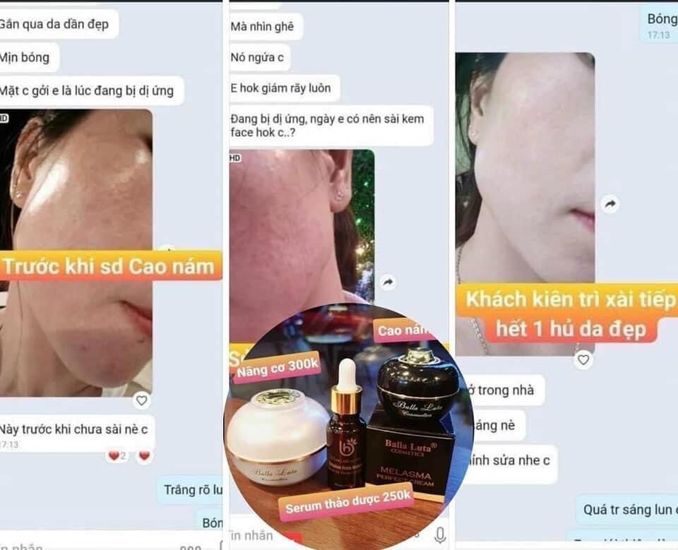 [HCM]SERUM THẢO DƯỢC BALLA LUTA