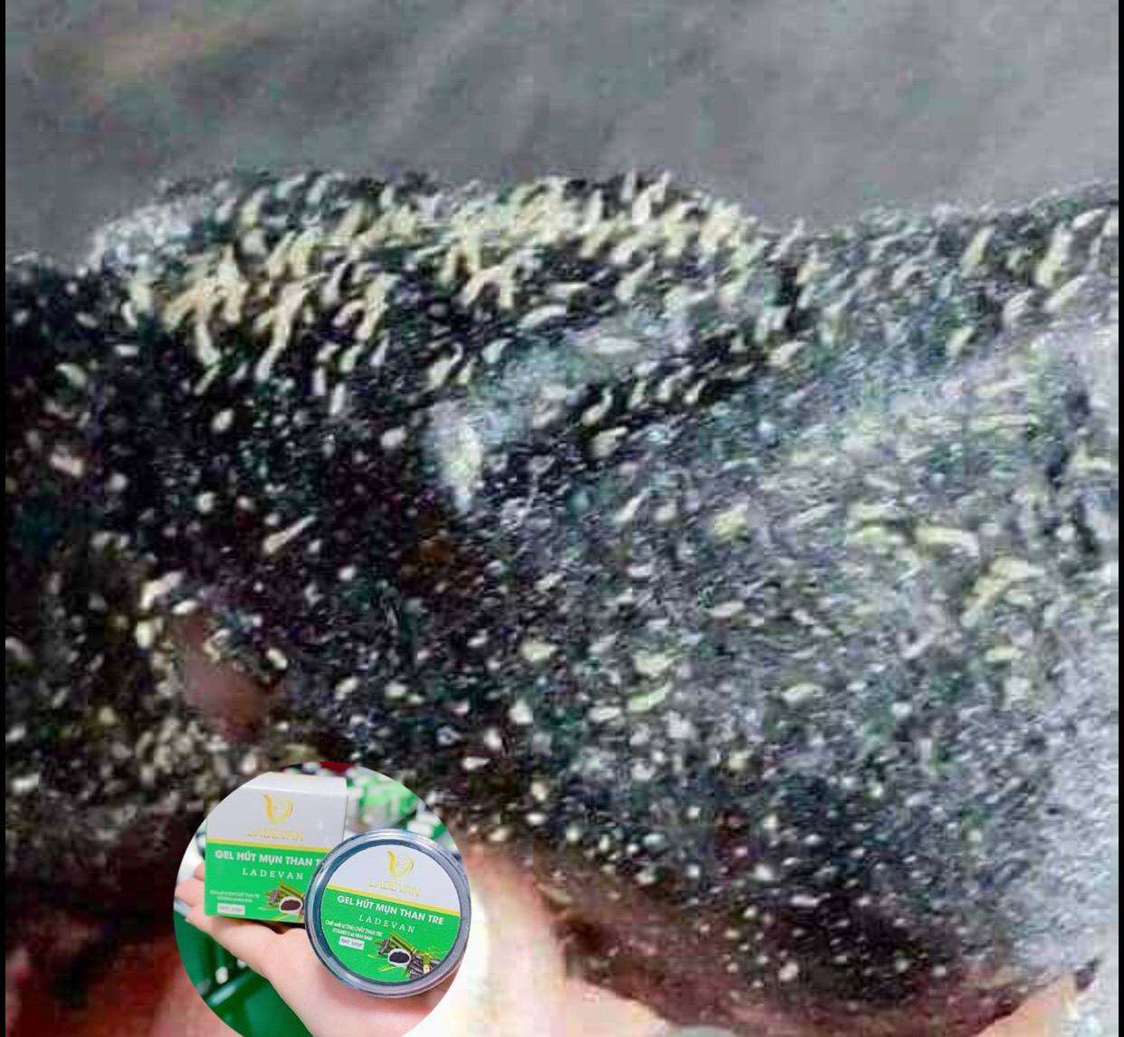 Gel hút mụn  than tre hút sạch mụn cám mụn đầu đen, thải độc da