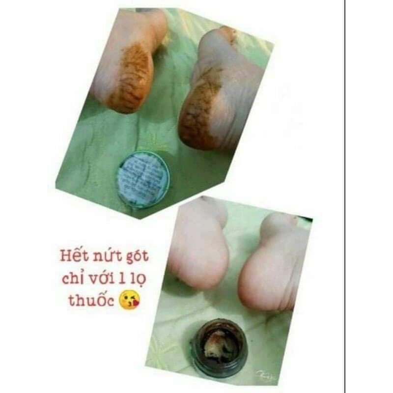 DƯỠNG DA TRẦN KIM HUYỀN