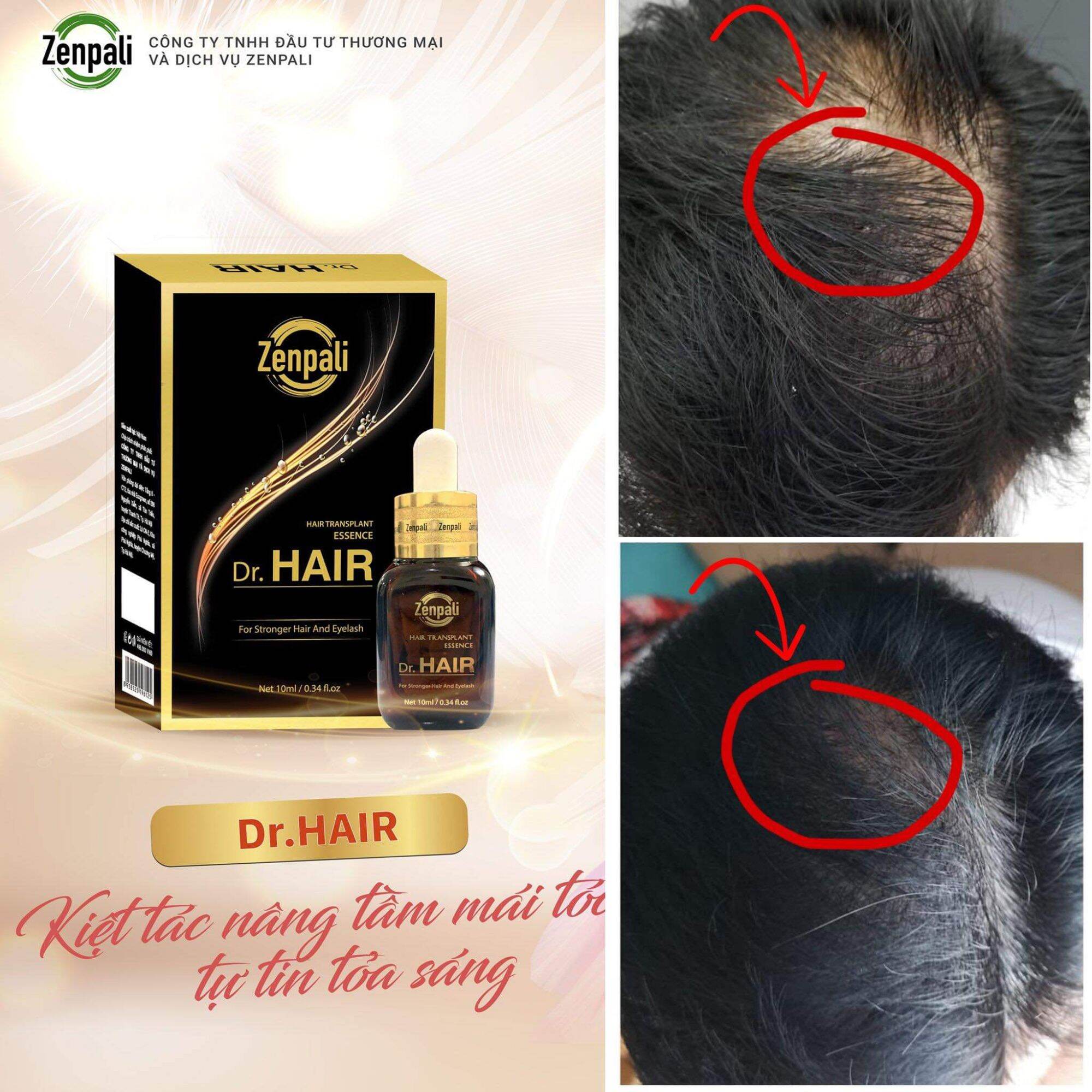 Dưỡng Mi Mọc Tóc Dr.hair Mua 1 Tặng 1 Xóa Tan Nổi Lo Hói Đầu