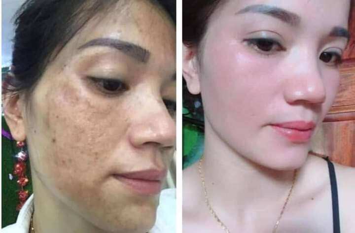 kem dưỡng trắng da face ngọc trai CRD
