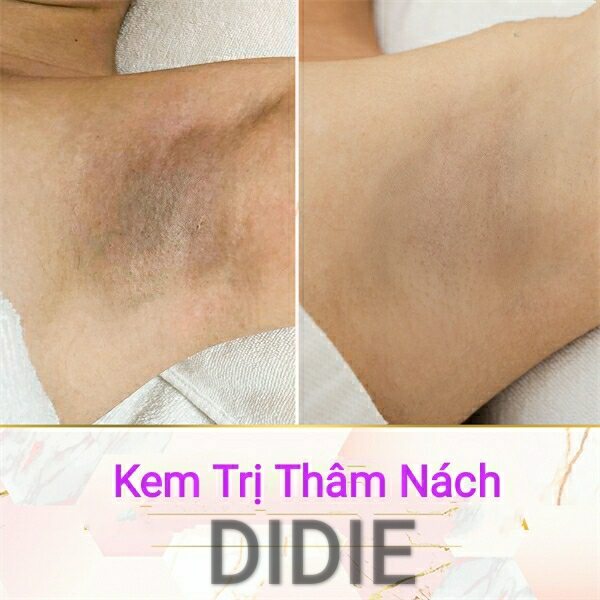 Kem Hết Thâm Nách DIDIE