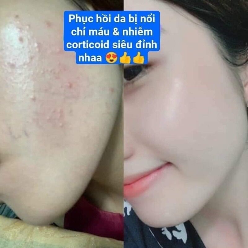 Kem Dưỡng Sáng Trắng Da Face Queen Mini Size 10g