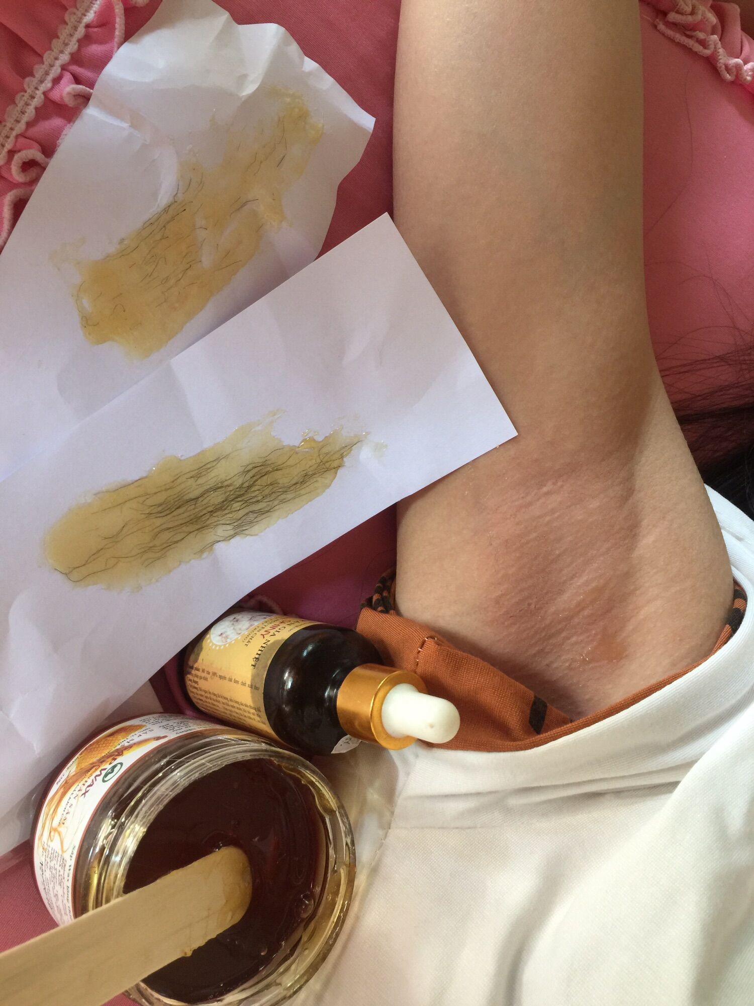 Combo Triệt Lông Sáp Wax + Mỡ Trăn Shiny Handmade(Tặng Kèm Dụng Cụ Wax)