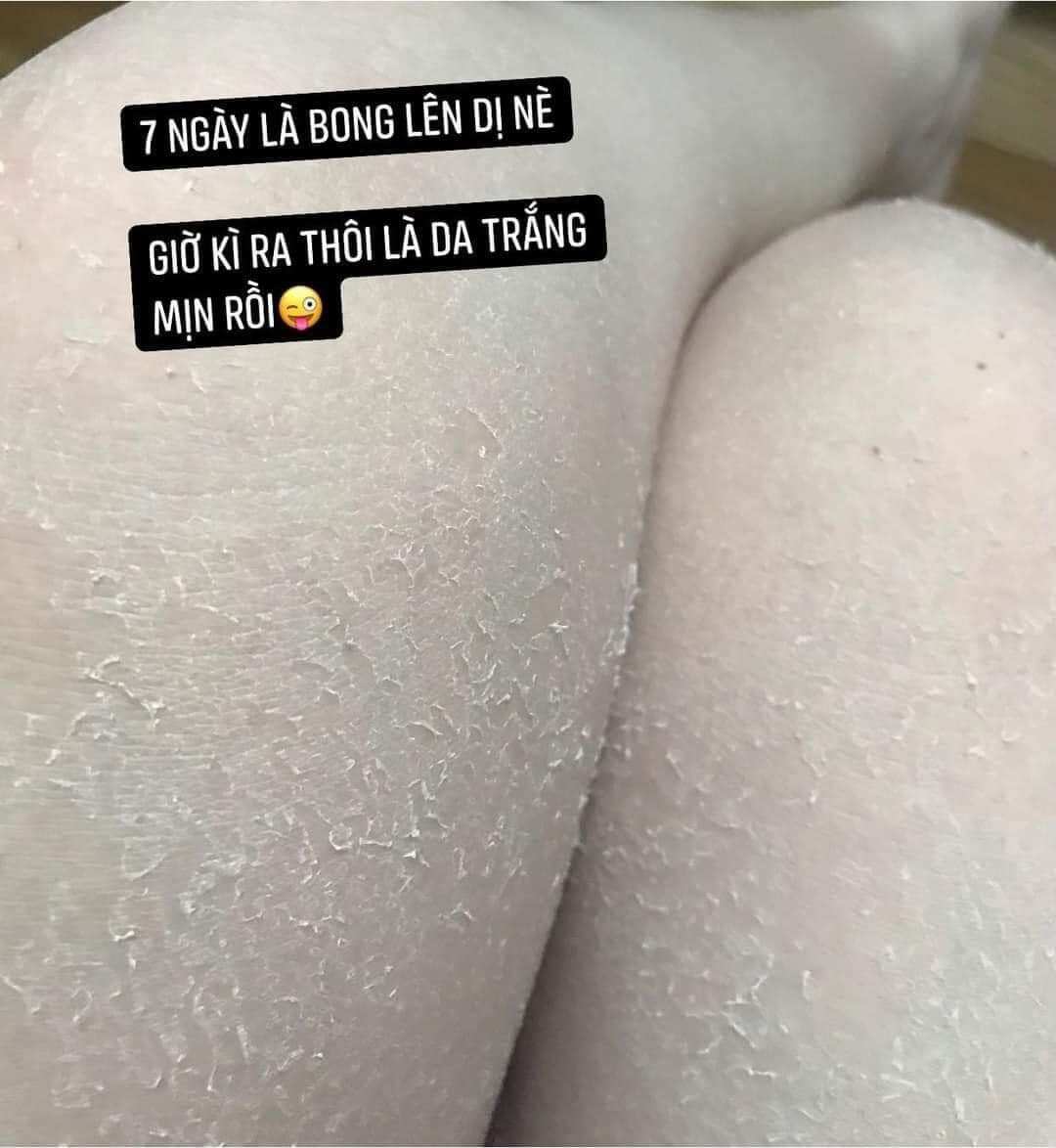 Body Bong Da Trắng Sau 7 Ngày