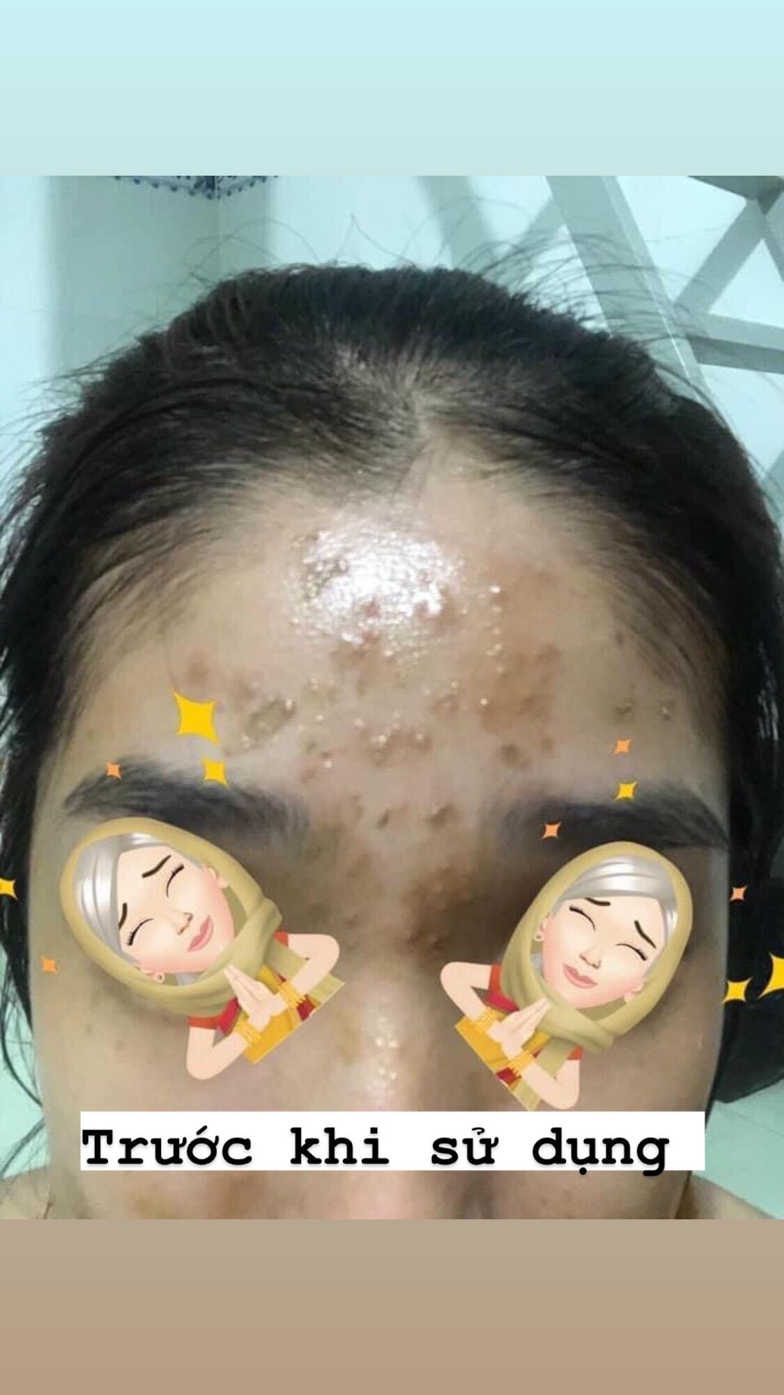 Sữa Rửa Mặt Nhân Sâm 36 Vị Chính Hãng